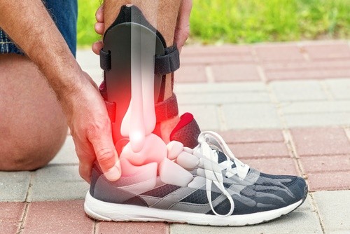 Shoes for Peroneal Tendonitis Buying Guide
